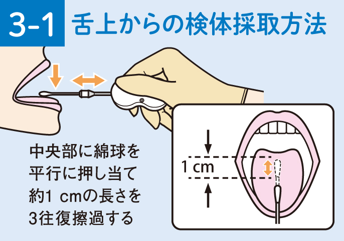イラスト:3-1.舌上から検体採取方法