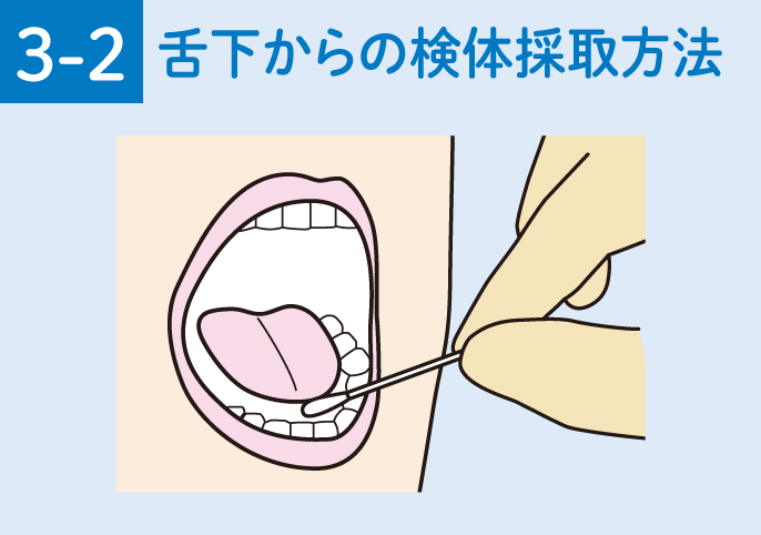 イラスト:3-2.舌下から検体採取方法