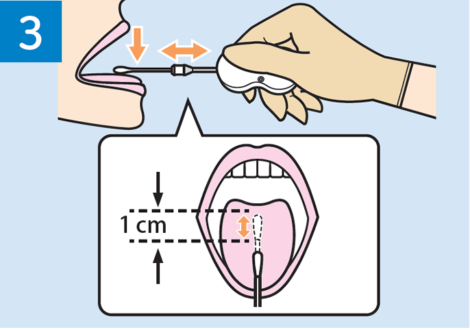 イラスト:3.口腔内の検体を採取