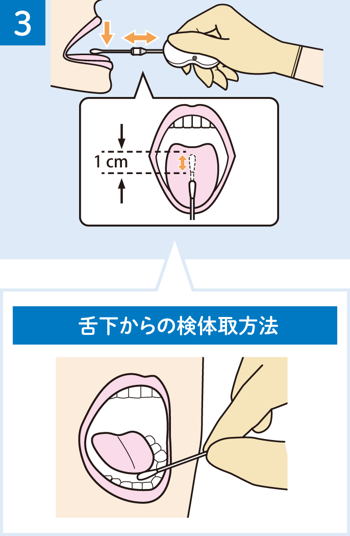 イラスト：３．口腔内の検体を採取
